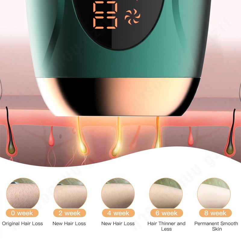 ipl-เครื่องเลเซอร์กําจัดขนถาวร-เลเซอร์น้ำแข็ง-เครื่องกำจัดขน-จัดขน-เลเซอร์ขนรักแร้ขน-ipl-laser-permanent-hair-removal