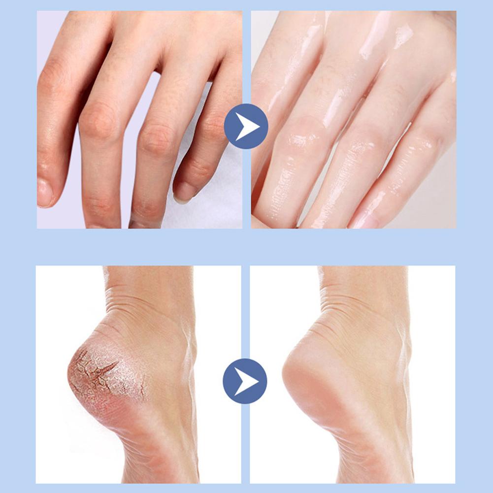 vaseline-ครีมทามือ-เท้าแตก-ให้ความชุ่มชื้น-ป้องกันผิวตาย-i2d4