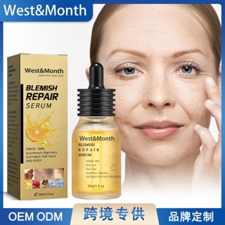 Spot# West &amp; Month freckle repair essence anti-wrinkle skin rejuvenation skin fading facial wrinkles fine lines spots 8jj