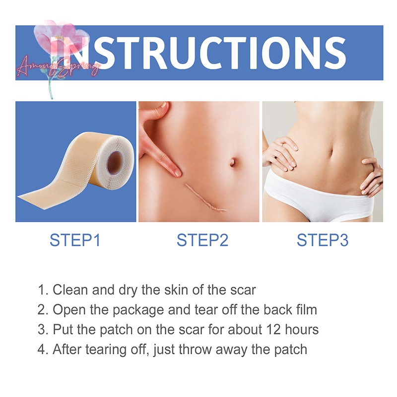 amongspring-gt-แผ่นซิลิโคน-ไม่เจ็บแผลเป็น-ซ่อมแซมรอยแผลเป็น-เทปม้วน-มีประสิทธิภาพ-แถบกําจัดรอยแผลเป็น-สําหรับ-c-section-keloid-surgery-burn-acne-ใหม่