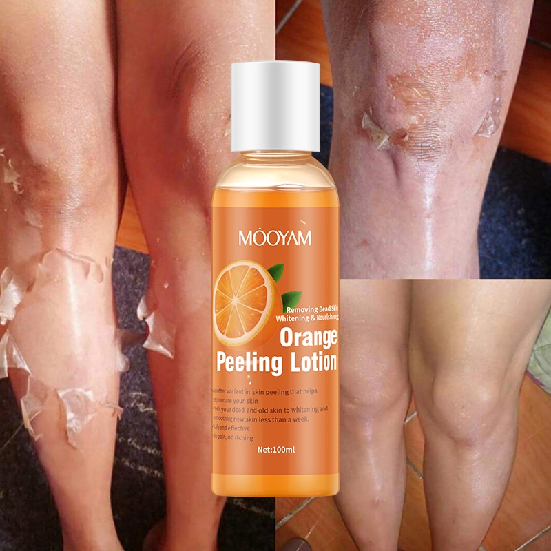 hot-sale-orange-peel-lotion-peeling-oil-body-lotion-mild-exfoliating-gel-gel-condensation-orange-peeling-lotion8cc