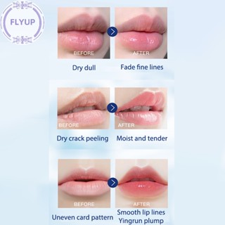 VASELINE Flyup ลิปบาล์มวาสลีน ให้ความชุ่มชื้น ป้องกันการแตกร้าว ซ่อมแซมผิว ติดทนนาน