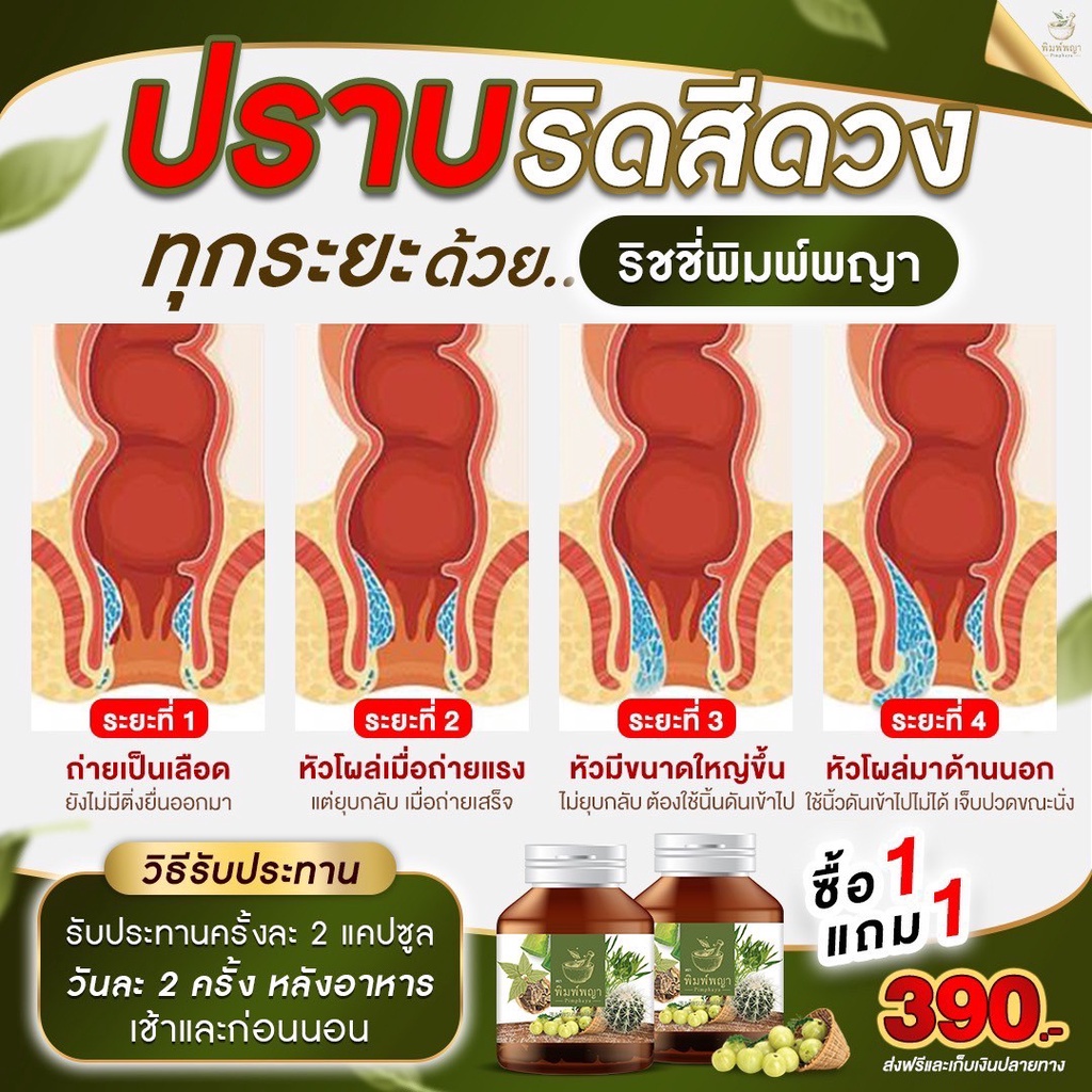 1-กระปุก-30แคปซูล-ริชชี่พิมพ์พญา-สมุนไพร-ริดสีดวงริชชี่พิมพ์พญา-สมุนไพรริดสีดวง-ติ่งฝ่อ-ติ่งยุบ-ติ่งบวม-ติ่งอักเสบ-แสบ