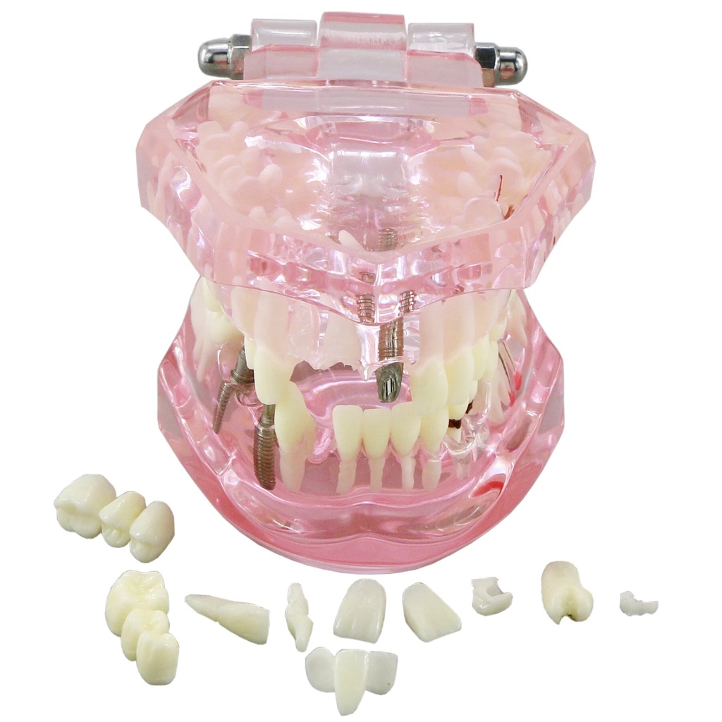 Multiple Types Dental Model Teeth Dental Teaching Models Study ...