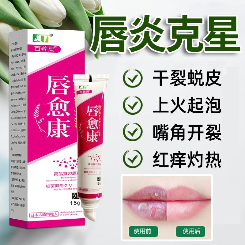 Spot cheilitis lip chapped peeling cheilitis Cream Lip rot corners lip