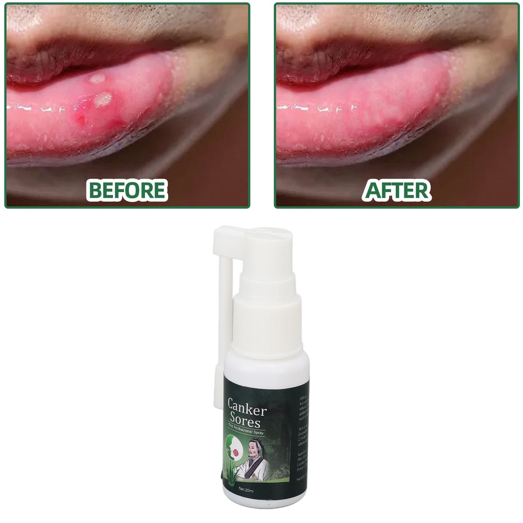 bm3-สเปรย์บรรเทาอาการปากนกกระจอก-men-women-herbal-extract-mouth-sre-relief-spray-for-daily-oral-care-20ml