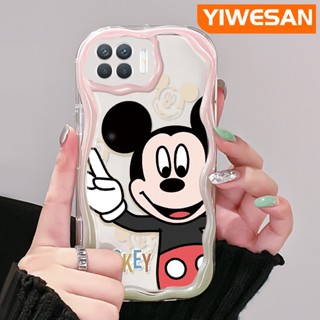 เคสโทรศัพท์มือถือ ซิลิโคนใส กันกระแทก ลายการ์ตูนมิกกี้เมาส์น่ารัก สีครีม สําหรับ OPPO A93 2020 F17 Pro Reno 4F Reno 4 Lite