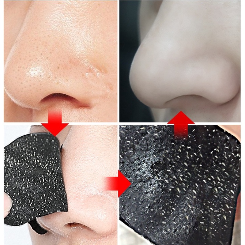 featured-rosotena-อุปกรณ์ทําความสะอาดผู้หญิง-สติกเกอร์จมูก-กระชับรูขุมขน-แผ่นแปะจมูกกําจัดสิวหัวดํา-แผ่นมาส์กจมูกทําความสะอาดรูขุมขนอย่างล้ําลึก-ผลิตภัณฑ์ดูแลผิว