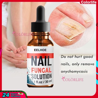 Eelhoe น้ํามันซ่อมแซมเล็บ สีเทา ป้องกันการติดเชื้อ สําหรับ Onychomycosis และ Keratitis