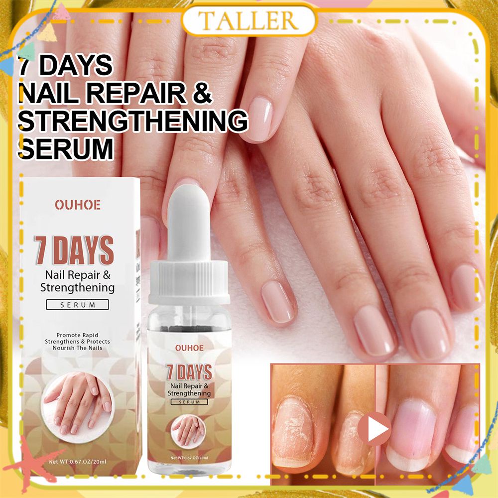 Ready Stcok Ouhoe 7day Nail Repair Essence Relieve Hand Foot