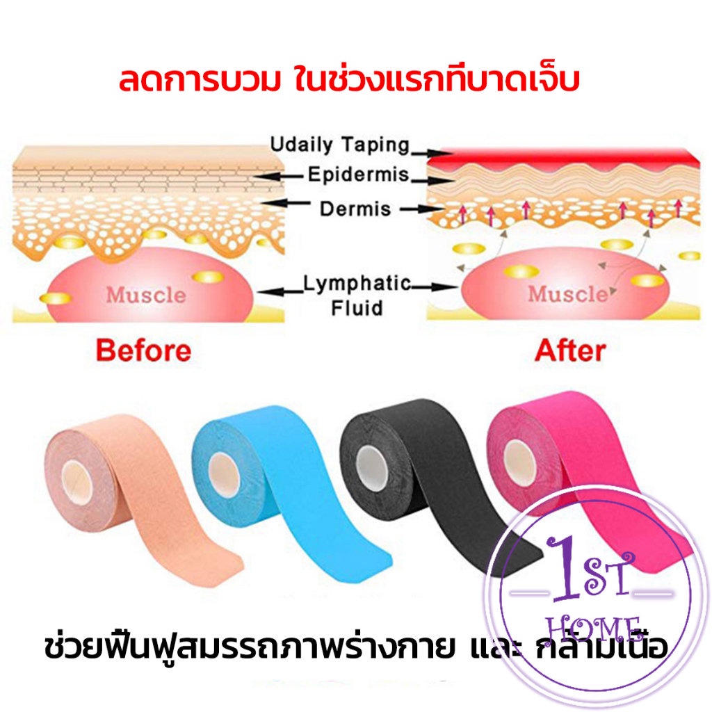 เทปบำบัด-พันกล้ามเนื้อ-5cmx5m-2-5cmx5m-คิเนสิโอ-มีกาวในตัว-sports-bandage