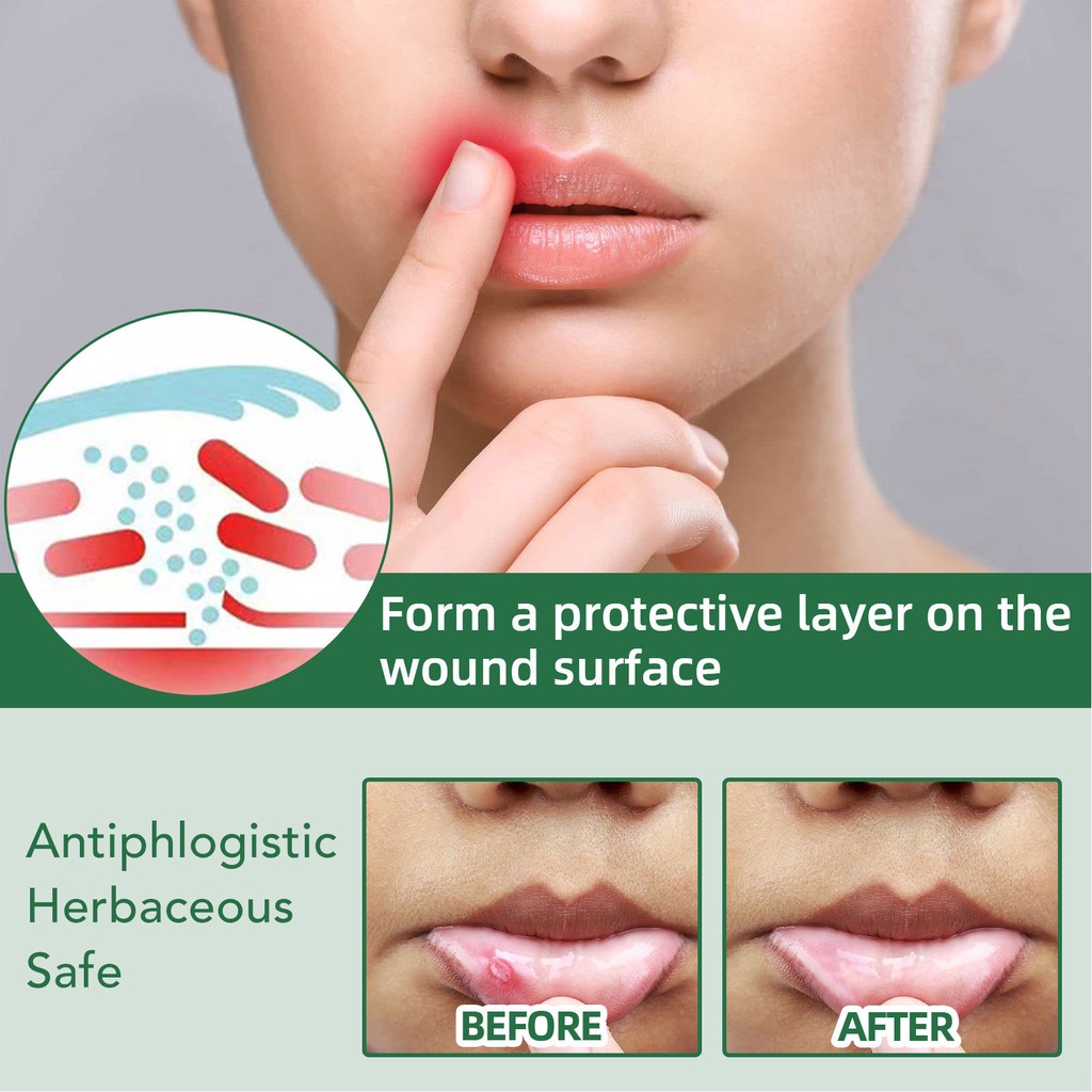 bm3-สเปรย์บรรเทาอาการปากนกกระจอก-men-women-herbal-extract-mouth-sre-relief-spray-for-daily-oral-care-20ml