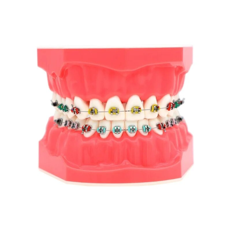 Dental Orthodontic Model with Bracket Arch Wire Ligature Tie 1:1 ...