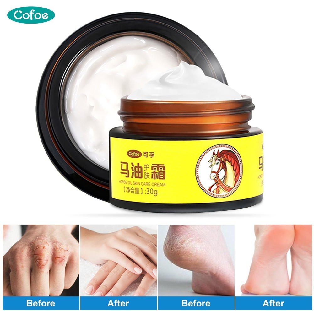 Cofoe 30กรัม/กล่องน้ำมันม้าครีมทาเท้า AntiChapping Skin Repairing