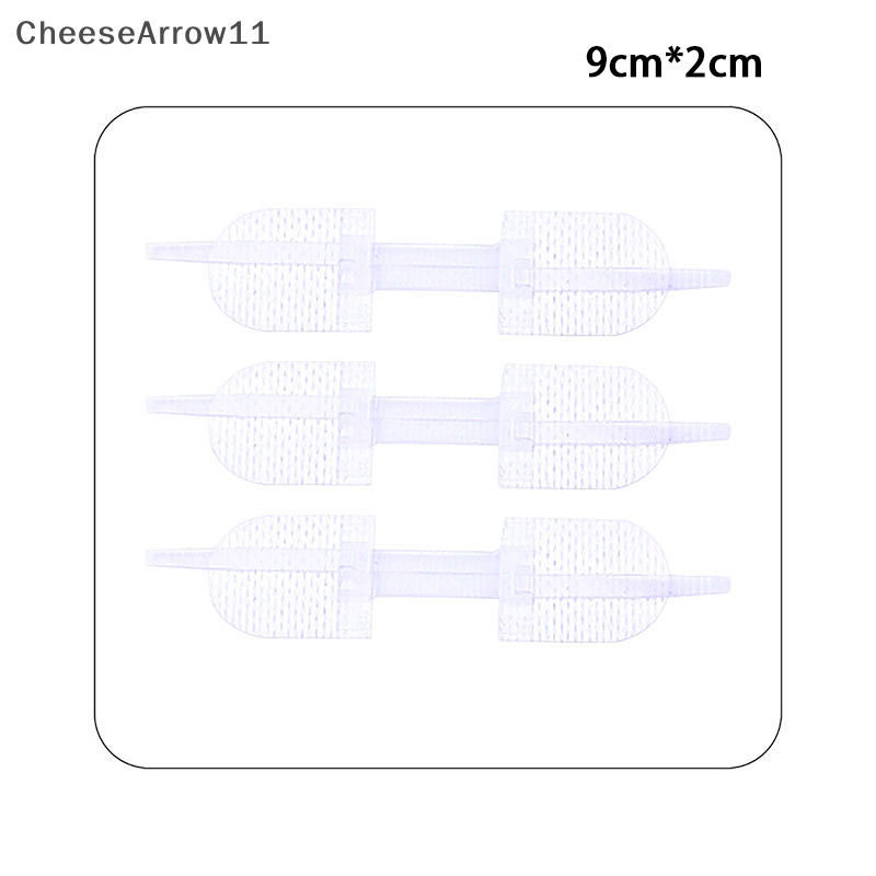 Che Zipper Tie Wound Closure Patch Hemostatic Patch Wound Fast Suture ...