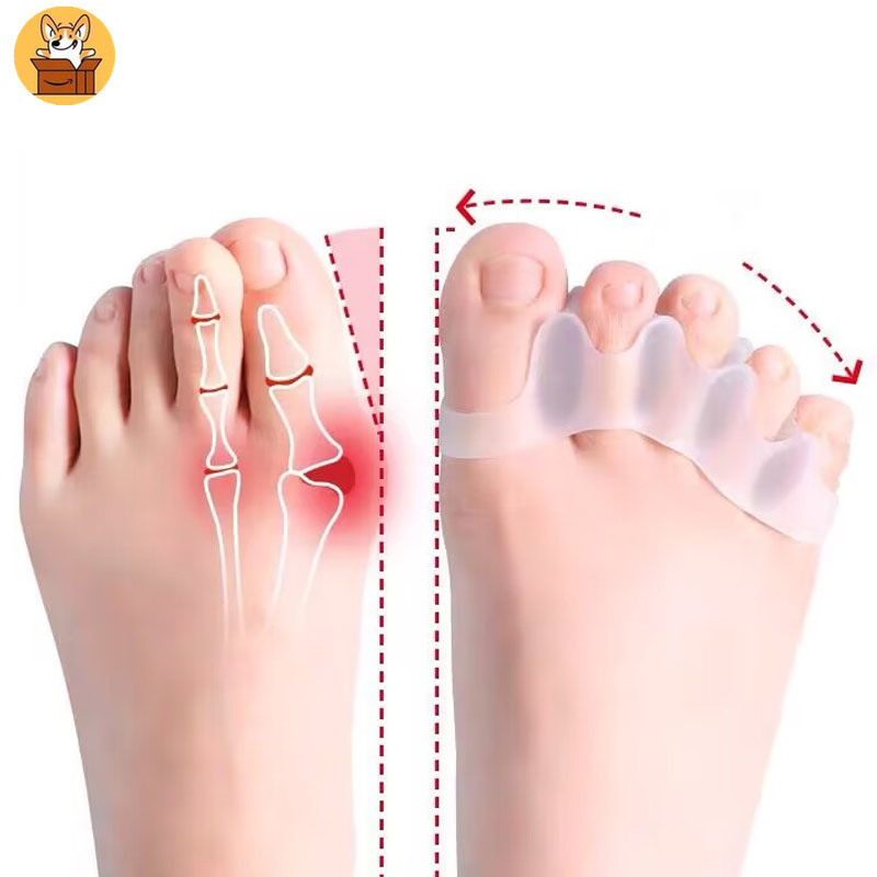 Am-az2Pc ซิลิโคน Toe Separator นิ้วฟุต Toe Spreader Hallux Valgus ...