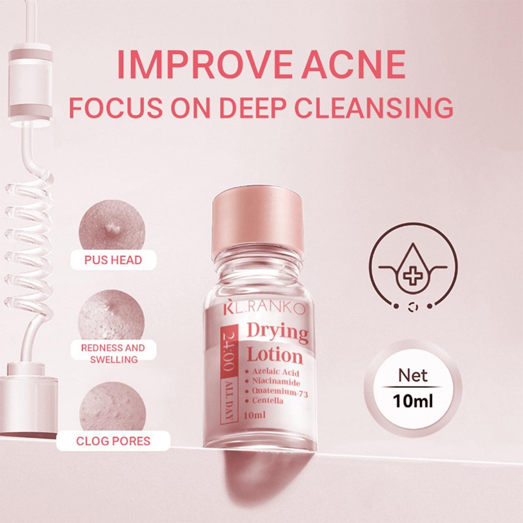สิว Drying Lotion 10ml Pimple Drying Solution Zit Moisturizer Soothing ...