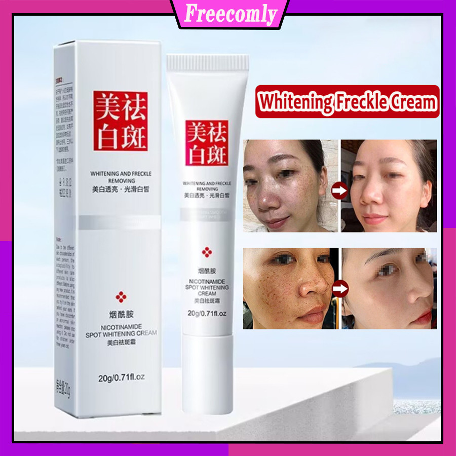 ที่มีประสิทธิภาพ Anti Freckle ครีมไวท์เทนนิ่ง Facial Dark Spot ...