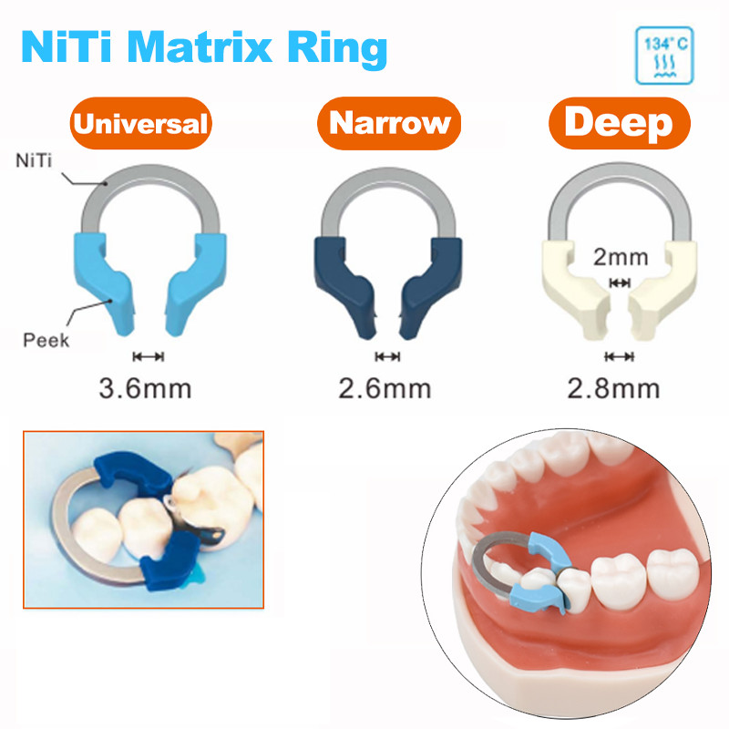 1 ชิ้นทันตกรรม Matrix Bands NITI โลหะ Matrices Clamp แหวนส่วน Contoured ...
