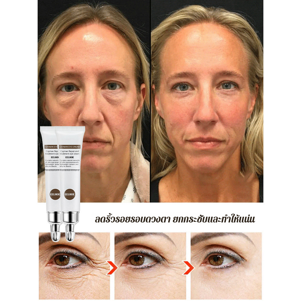 ⚡⚡อายครีม ครีมบำรุงรอบดวงตาสูตรลดริ้วรอย Anti-wrinkle essence eye cream ...