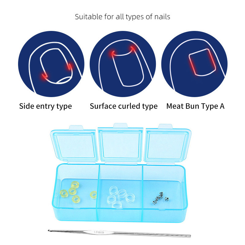 IFA คุด Toenail Corrector Pedicure กู้คืน Embed Toe Nail Treatment ...