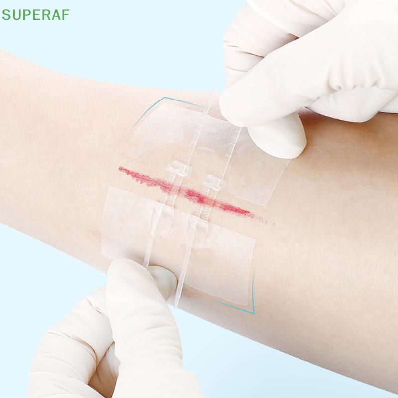 SUPERAF 1/2 ชิ้นซิป Tie Wound ปิด Patch Hemostatic Patch Wound Fast ...
