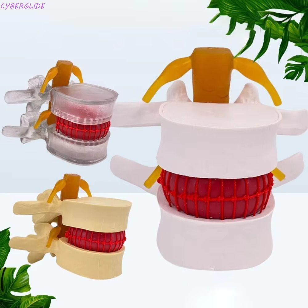 CYBERGLIDE Human Anatomy Skeleton Model, Spinal Pressure Lesions 3D ...