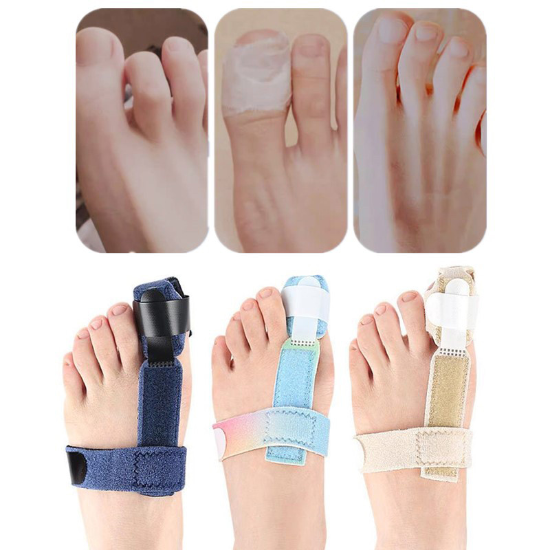 Heabety Toe Corrector Toe Fracture Fixator กายอุปกรณ์เสริมกระดูกเท้า ...