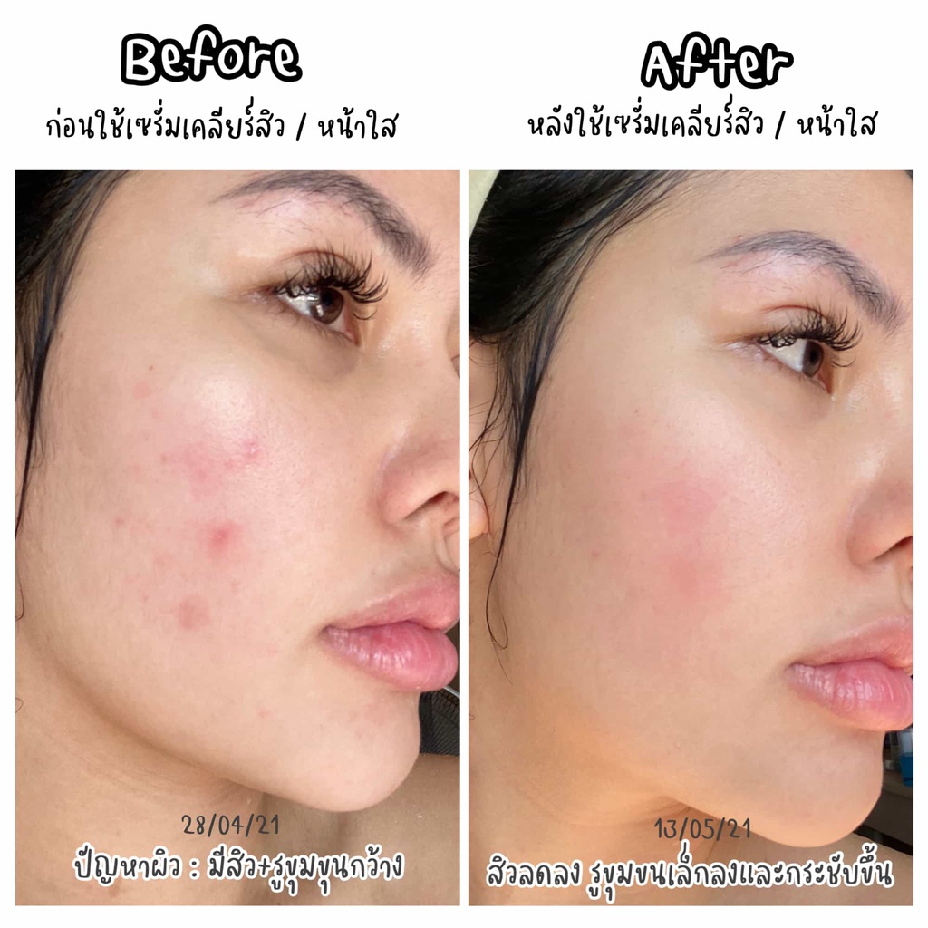 ภาพที่ให้รายละเอียดเกี่ยวกับ DERMADICT หน้าฉ่ำทางนี้ เด็ด เดิมมาดิก ไวท์เทนนิ่ง ซีรั่ม 30 มล. บำรุงผิว กู้ผิวกระจ่างใส คืนความชุ่มชิ้น อ่อนโยนต่อผิว