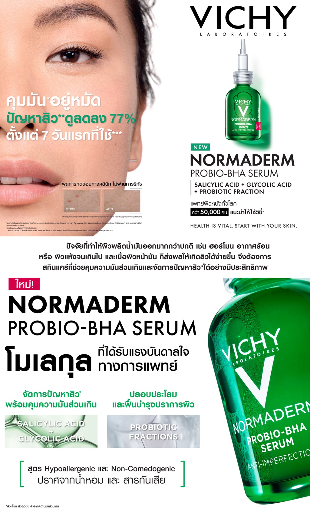 มุมมองเพิ่มเติมของสินค้า วิชี่ Vichy Normaderm Pro-Bio BHA Serum เซรั่มควบคุมความมันส่วนเกินจัดการปัญหาสิว 30 มล.