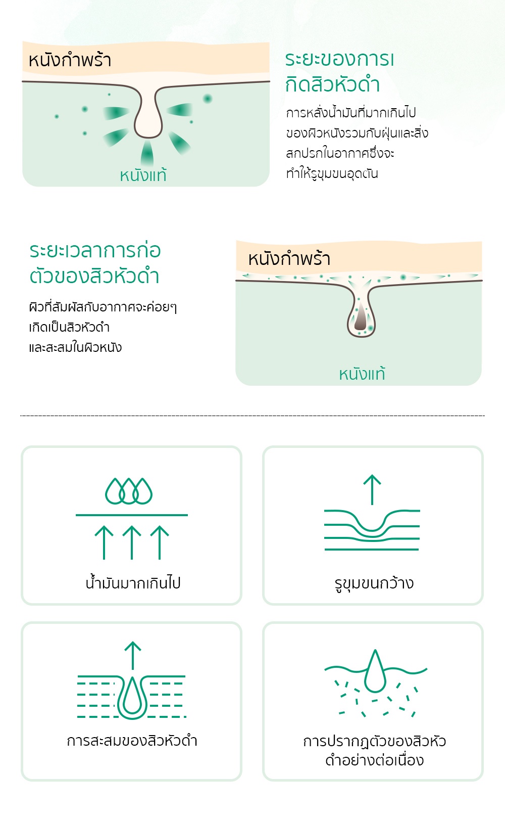 เกี่ยวกับ BREYLEE FDA กำจัดสิวหัวดำ เซรั่มบำรุงผิวหน้า สิวหัวดำ ลดสิว และกระชับรูขุมขน แผ่นลอกสิวเสี้ยน Blackhead Remover Mask Pore Tightening Serum 17ml