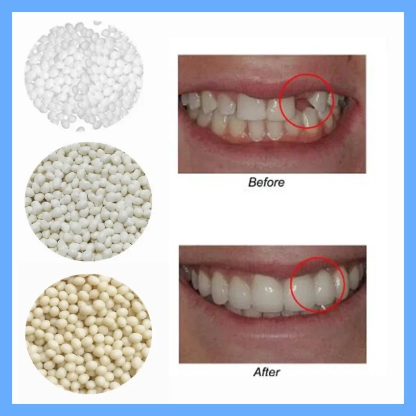 tk 3Colors Dental Oral False Fake Teeth Tooth Filling Repair Smile Snap ...