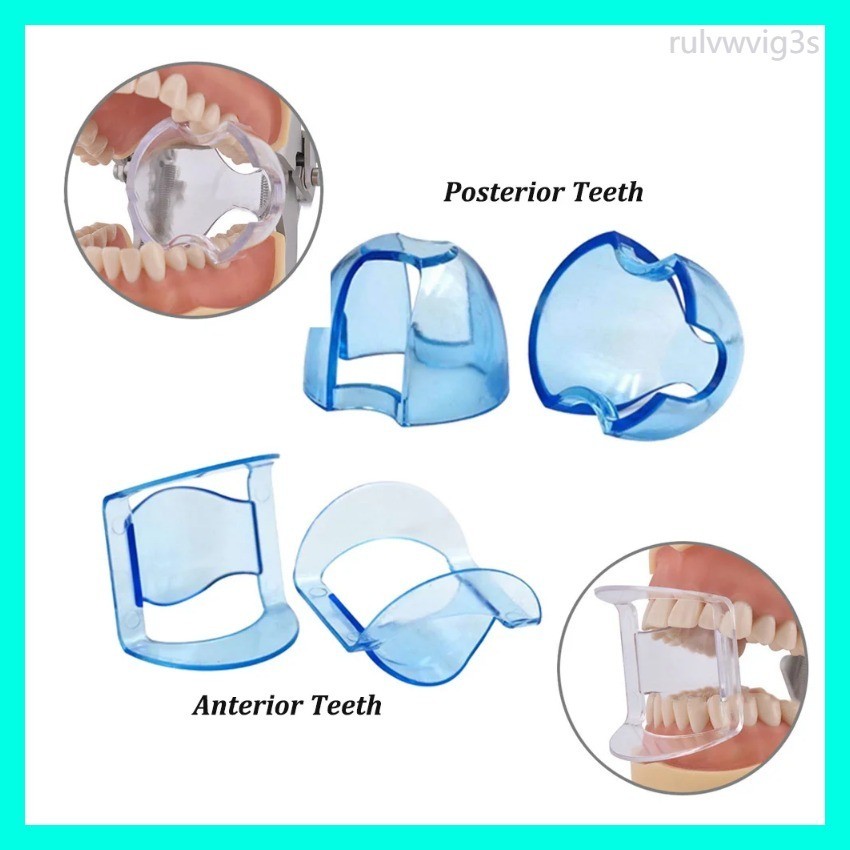 Dental Intraoral Cheek Retractor Lip Mouth Opener Tooth Whitening for ...