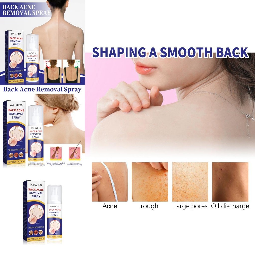 Jaysuing Back Care Spray สําหรับการทําให้บริสุทธิ์และรักษาสิวเฉพาะจุด Shopee Thailand