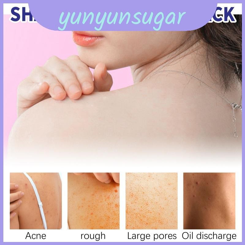 Jaysuing Back Care Spray สําหรับการทําให้บริสุทธิ์และรักษาสิวเฉพาะจุด Shopee Thailand