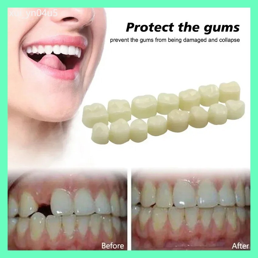 a 70/50pcs Dental Teeth Veneers Whitening False Denture Resin Temporary