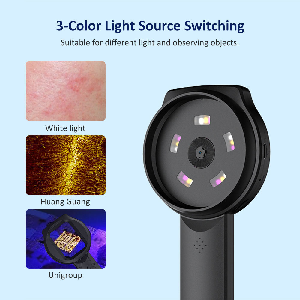 มือถือ 2.8in Facial Dermatoscope Skin Analyzer เครื่องแว่นขยายดิจิตอล ...