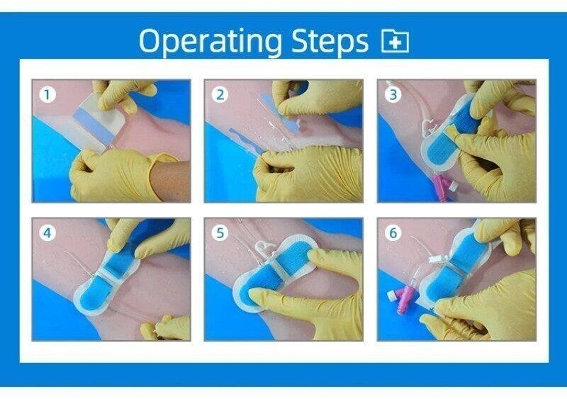 PICC/CVC Steile Medical Draining Tube Fixing Sticker Catheter Fixation ...