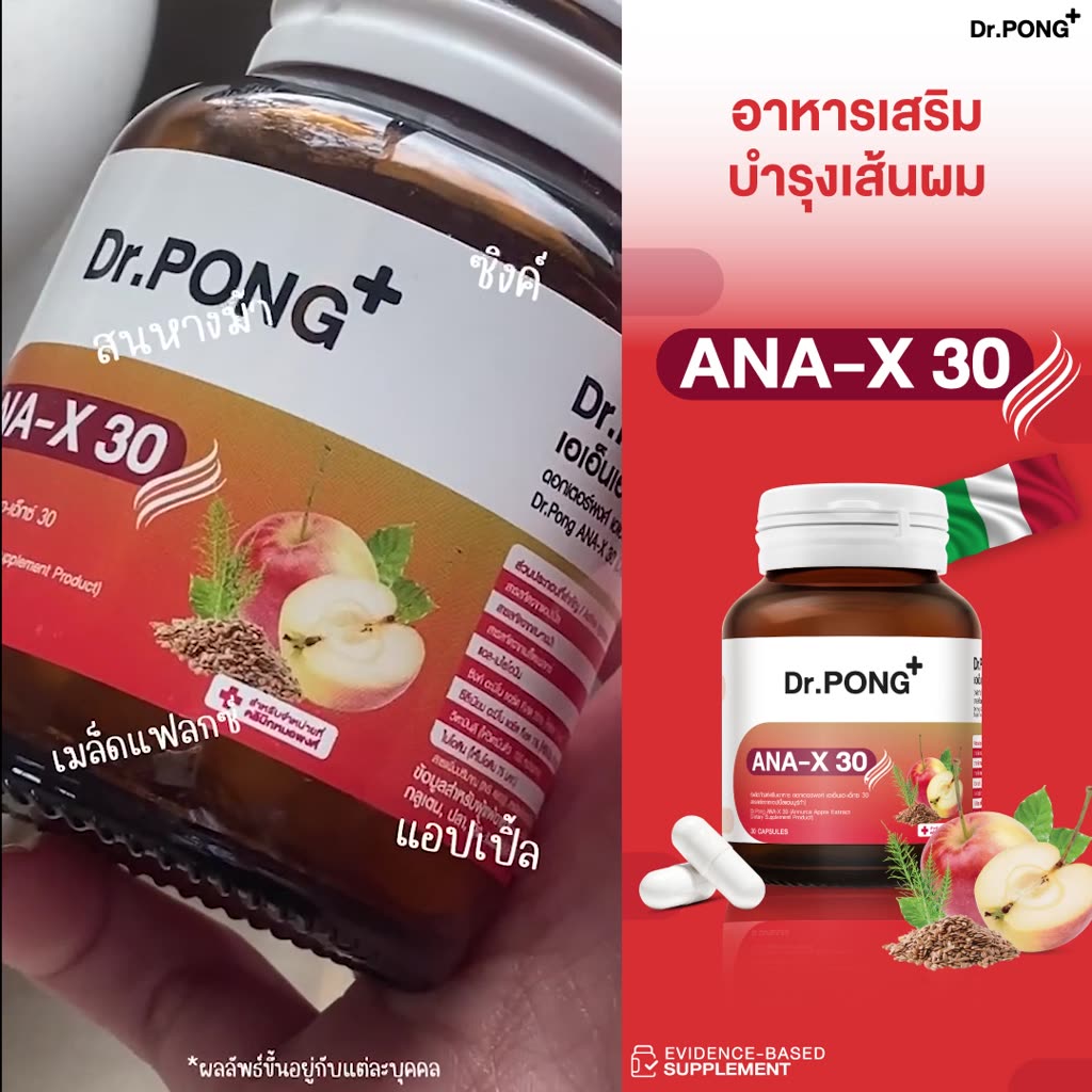 Dr.PONG ANA-X 30