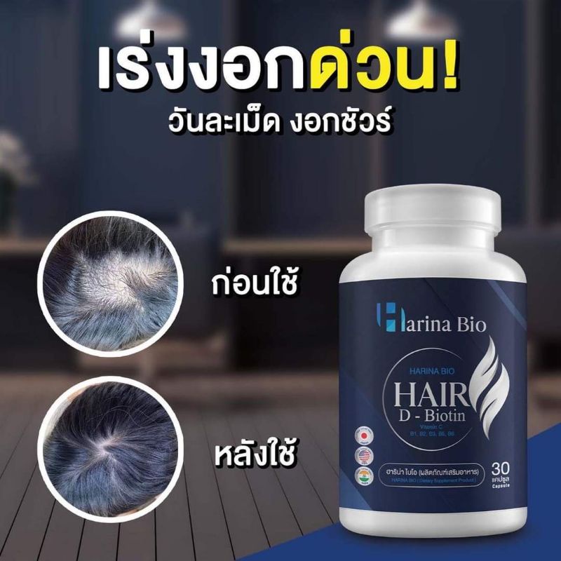 harina-bio-วิตามินบำรุงผม-แก้ผมร่วง-แก้หงอก-วิวิตามินแก้ผมร่วง-ผมบาง-หัวล้าน