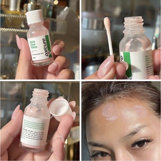 Oxe Cure Acne Clear Potion 15ml อ๊อกซีเคียว แอคเน่ เคลียร์ โพชั่น แต้มสิว สิวอักเสบ ลดรอยดำ ไม่ระคายเคือง