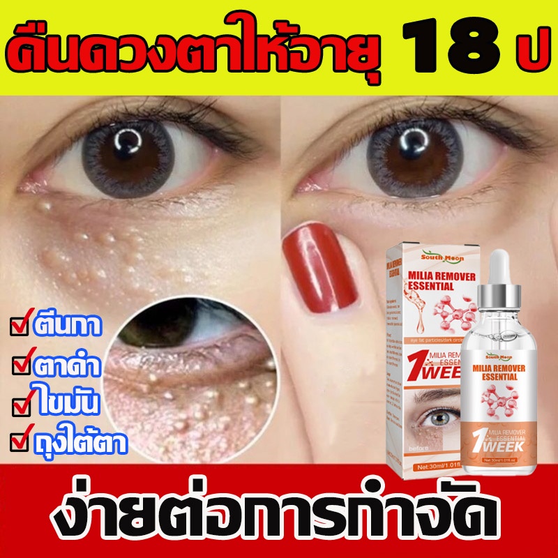 ครีมทารอบดวงตา30ml-ตีนกา-รอยคล้ำใต้ตา-ถุงใต้ตา-ขจัดอนุภาคไขมัน-เซรั่มถุงใต้ตา-ครีมทาตาเม็ดไขมัน-ครีมทารอบดวงตา-อายครีม