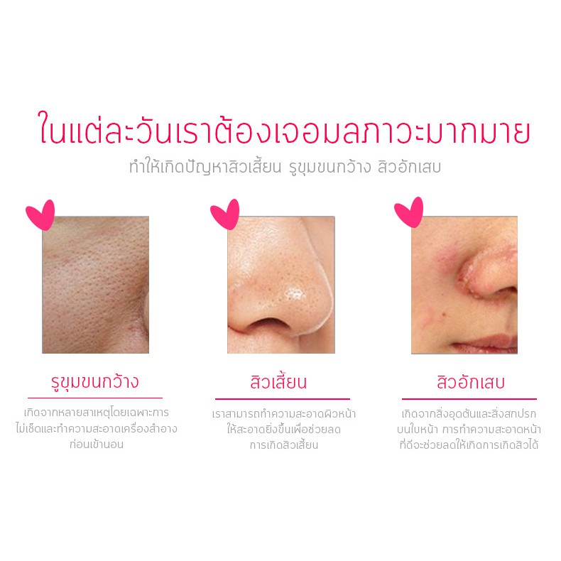 เครื่องทำความสะอาดผิวหน้า-แปรงล้างทำความสะอาดผิวหน้า