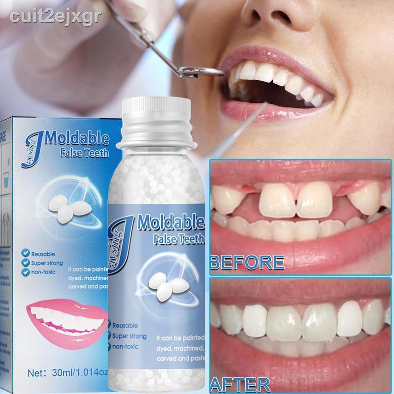 【Ready stock】30ml Resin Temporary Tooth Repair Granules Teeth Gaps ...