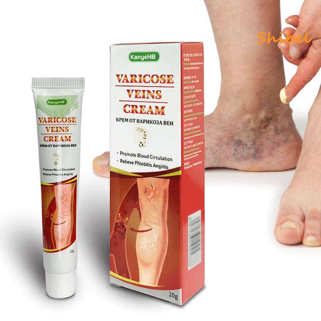 HL_ 20g Veins Cream Quick Effect Relieve Itching Natural Varicose ...