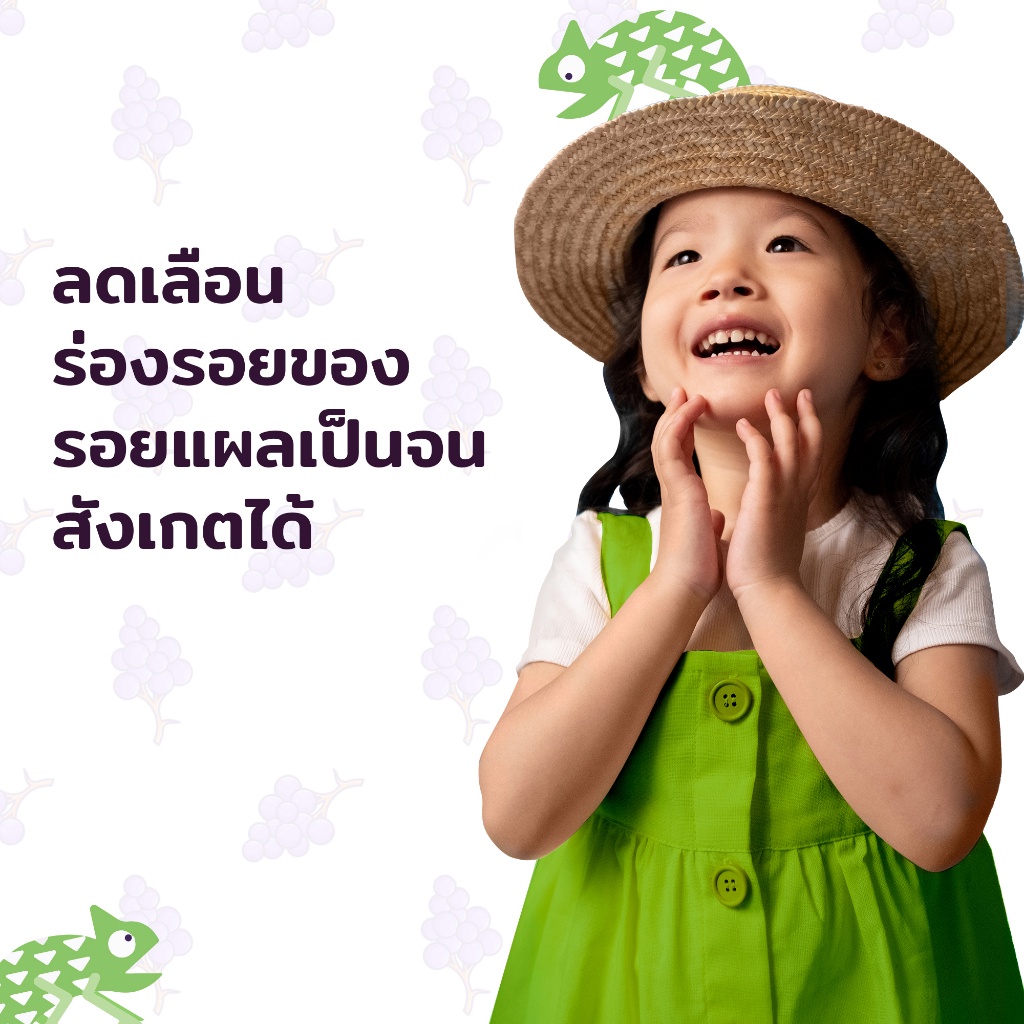 มีเดอม่า-สการ์-เจล-ฟอร์-คิดส์-mederma-scar-gel-for-kids-ขนาด-20-กรัม-1หลอด