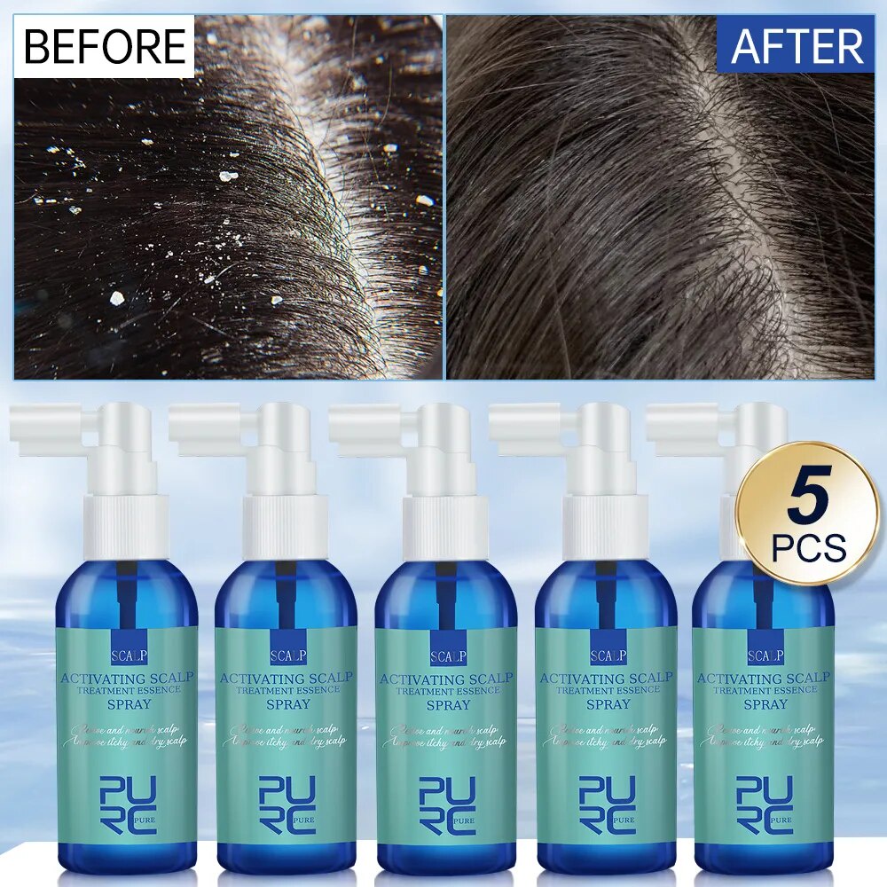 26W PURC 5PCS Hair Care Dandruff Treatment for Scalp Essence Spray
