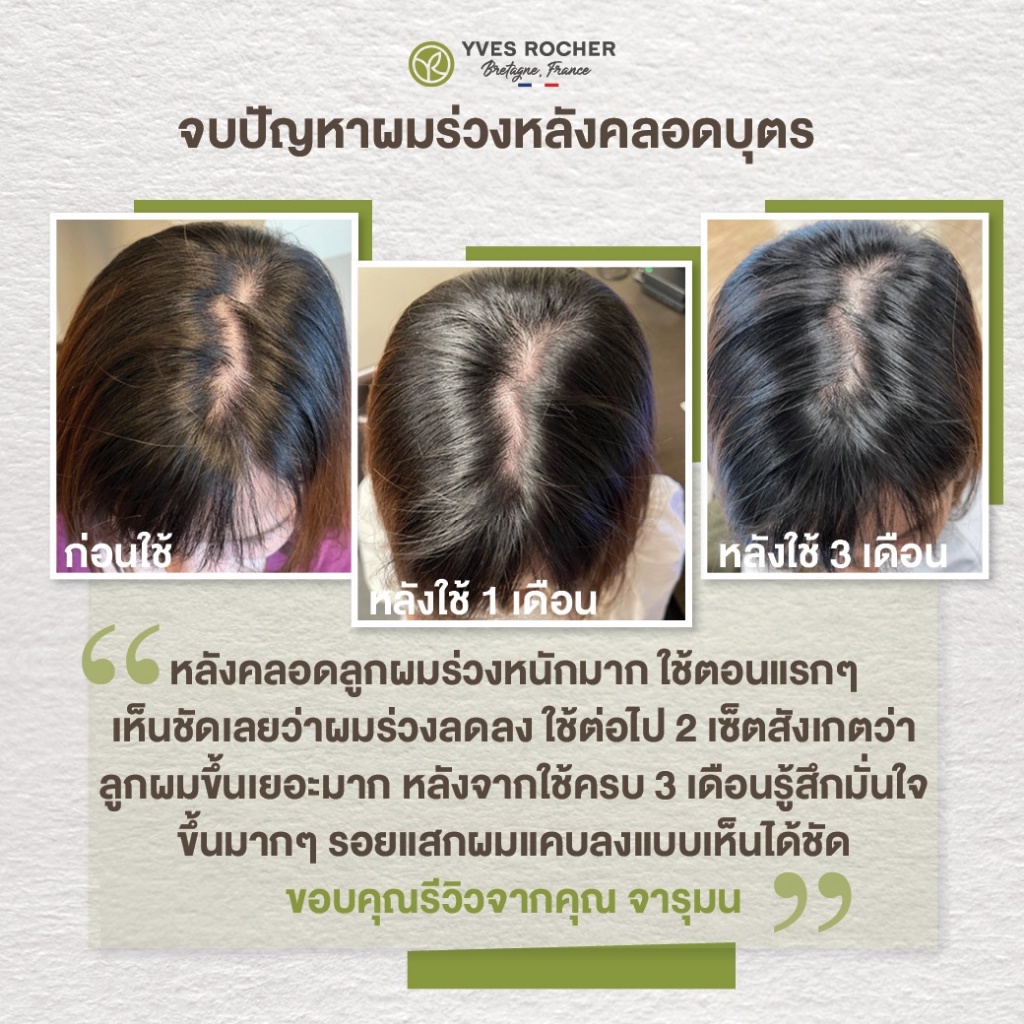 ลดเพิ่ม-8-ของแท้-100-yves-rocher-anti-hair-loss-shampoo-อีฟ-โรเช-แอนตี้-แฮร์-ลอส-แชมพู-300-มล-3-ขวด