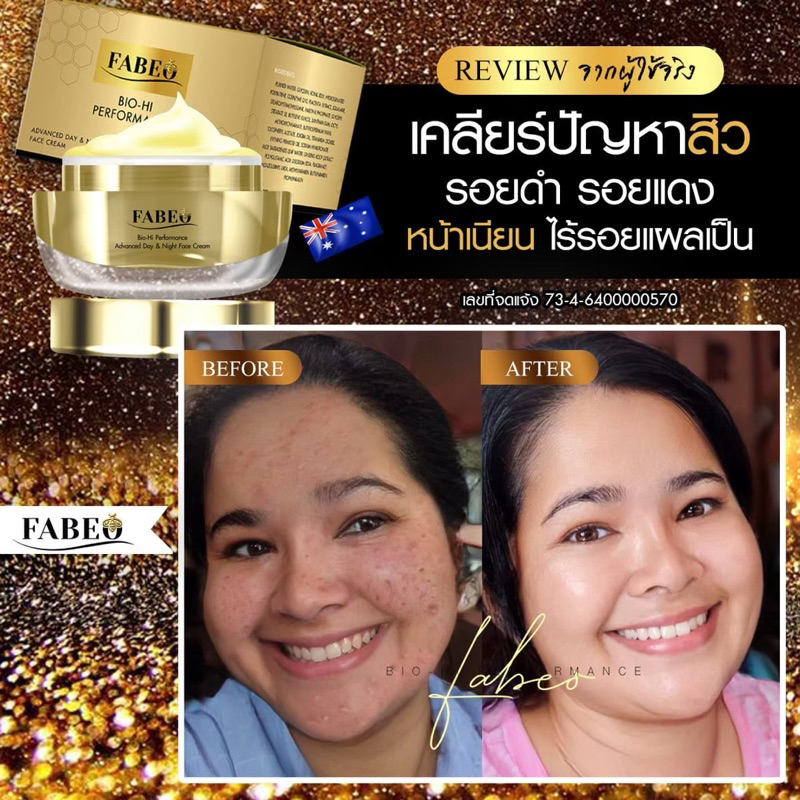 ส่งฟรี-fabeoฟาบีโอ้-ครีมจอยรินลณี-ครีมรกแกะ-ครีมย้อนวัยผิวและริ้วรอย-สำหรับผูหญิงวัย35