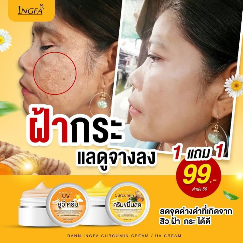 ของเเท้-พร้อมส่ง-ครีมขมิ้นสด-อิงฟ้า-รักษาสิว-สลายฝ้า-หน้าเด้ง